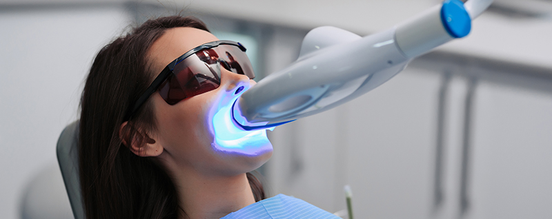 Things to Consider After Teeth Whitening