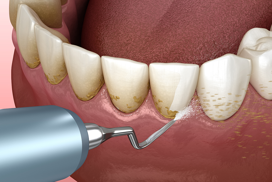 Periodontology Periodontology